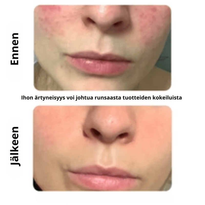 UUTUUS! La Crème Libre, Crème Légère - rasvoittuvan ja epäpuhtaan ihon hoitovoide, 30 ml - 4Organic Store (Luomukaista)